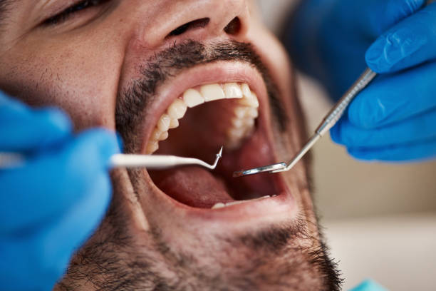 Best Same-Day Emergency Dentist in Plumsteadville, PA